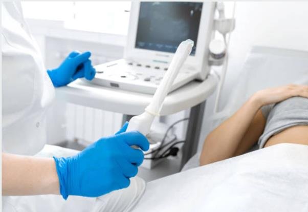 TVS (Transvaginal Ultrasound)