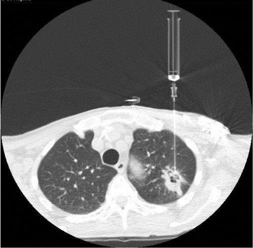 Ultrasound & CT Guided Procedures