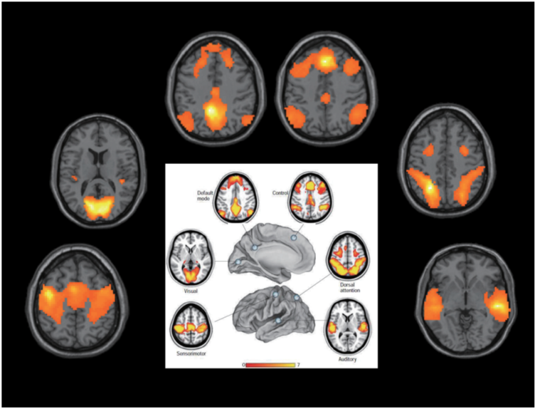 Functional MRI Brain 